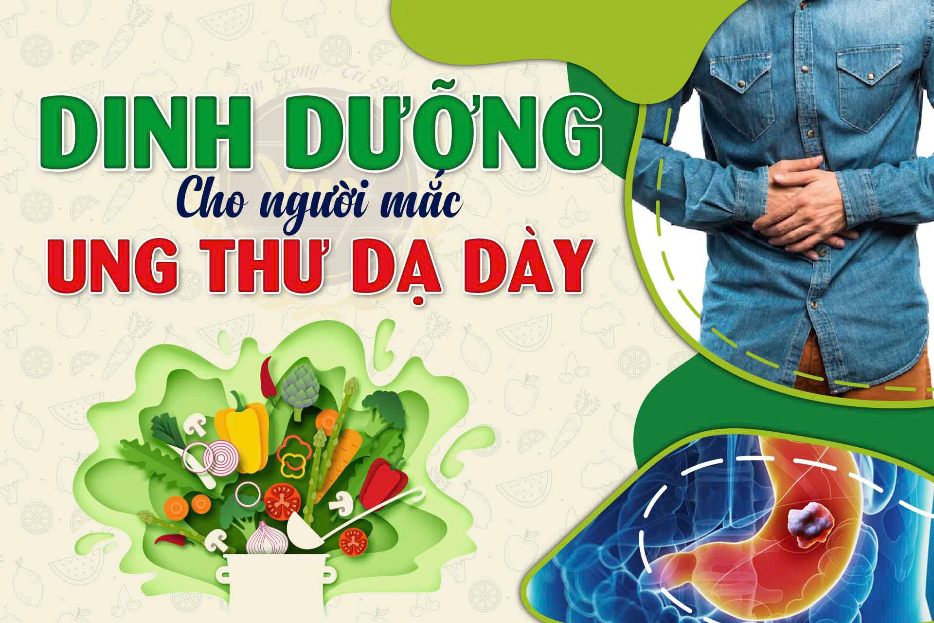 Dinh dưỡng cho người mắc ung thư dạ dày