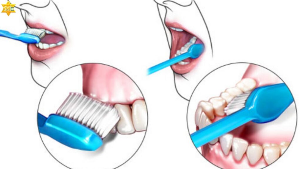 Chải răng bằng phương pháp Bass cải tiến