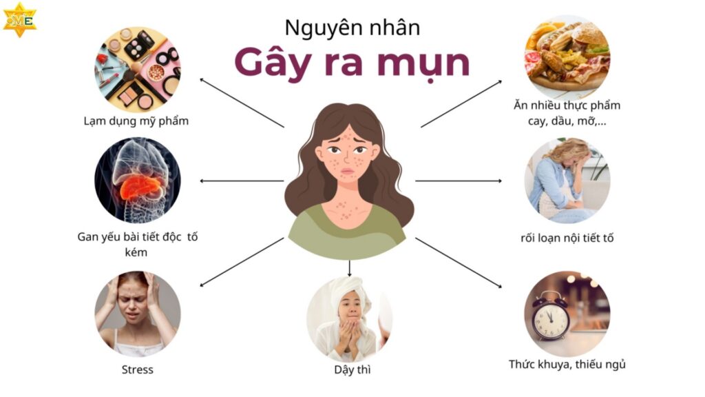 Nguyên nhân gây ra mụn