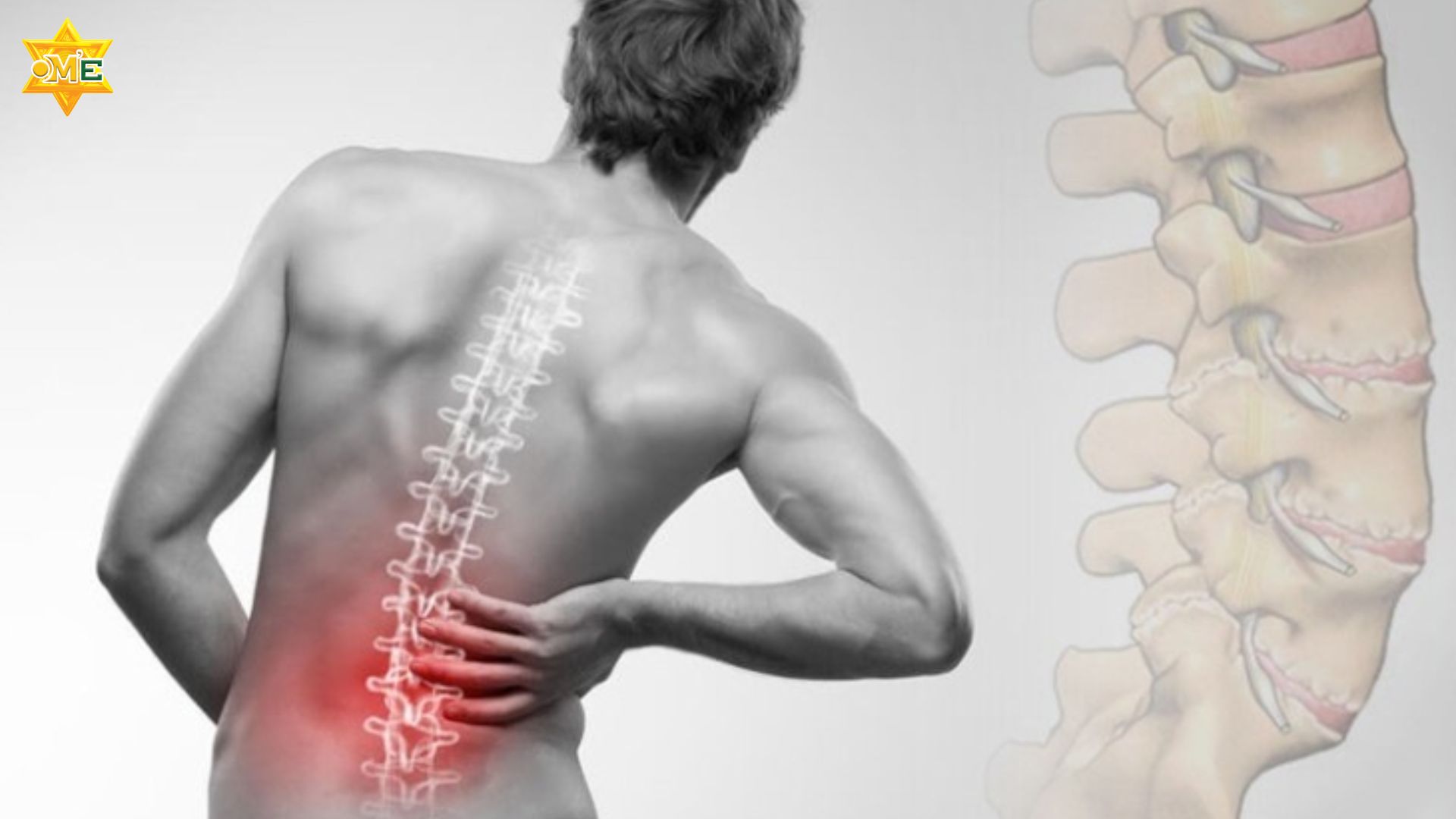 bài tập yoga cho người đau lưng