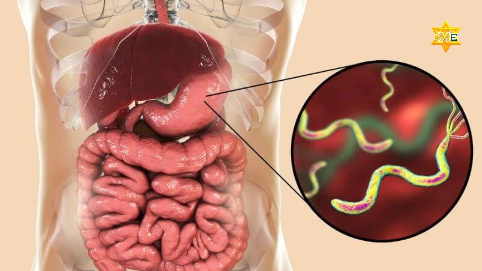 Triệu chứng của đau dạ dày là gì? Hiểu đúng để chữa đúng bằng Yoga