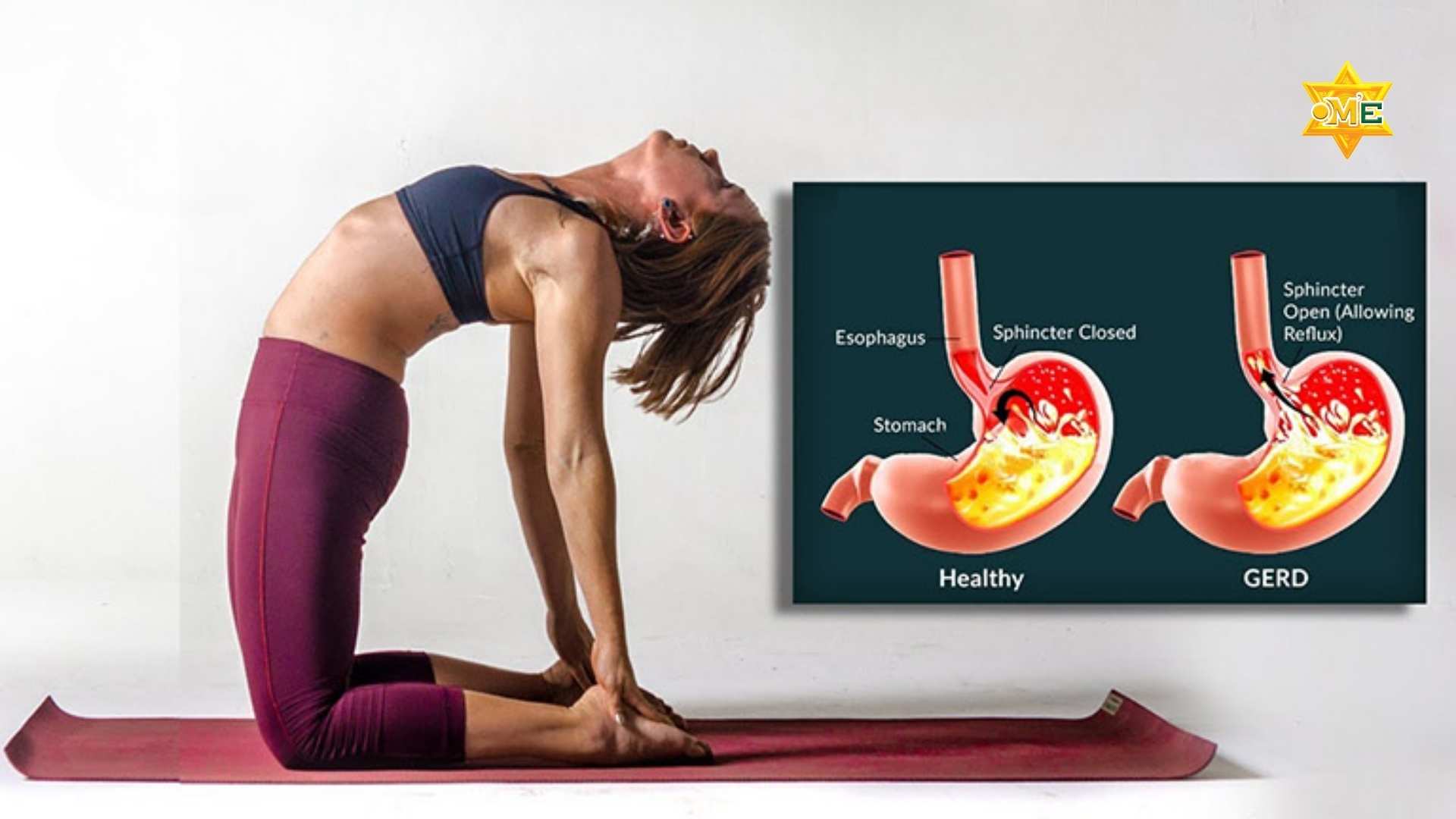 Triệu chứng của đau dạ dày