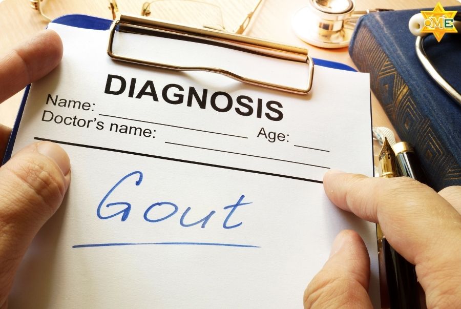 Bệnh gút sống được bao lâu? Lời giải đáp & Lộ trình kiểm soát Gout