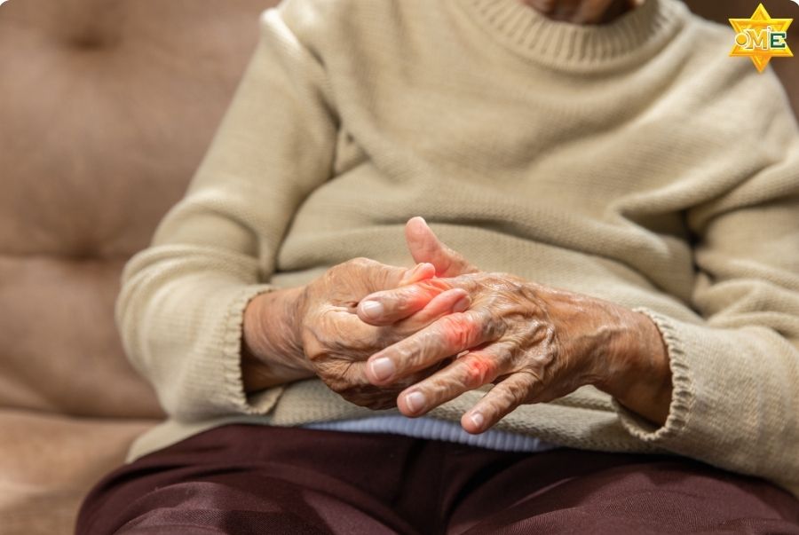 Gout có di truyền không? Hiểu đúng để phòng ngừa hiệu quả