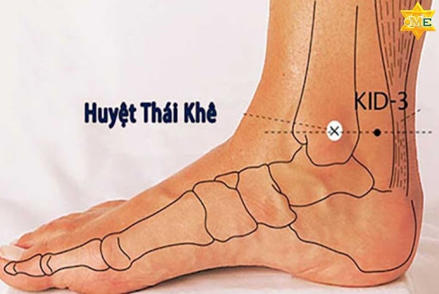 Ngăn ngừa bệnh gout tái phát theo Y học cổ truyền