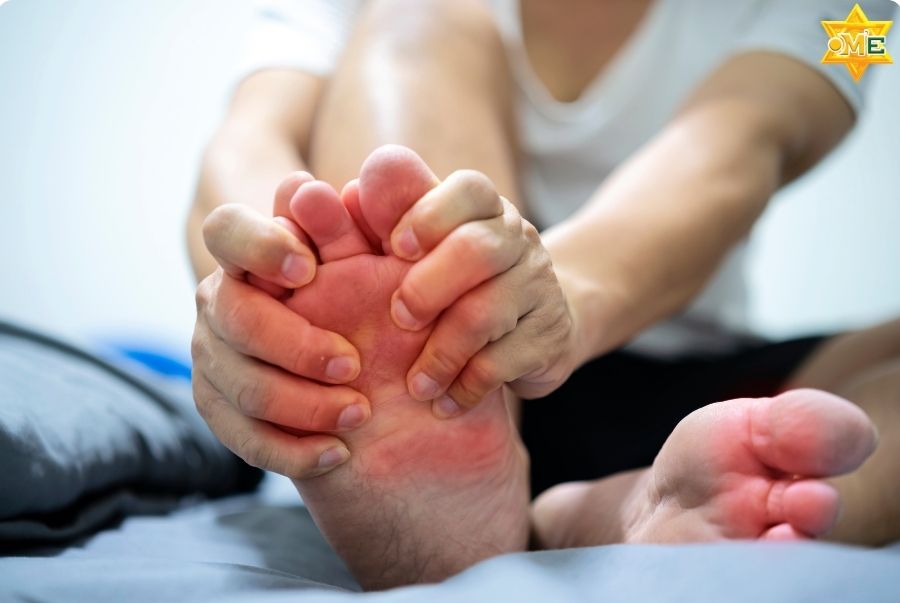 Dấu hiệu bị gout ở chân theo Y học cổ truyền