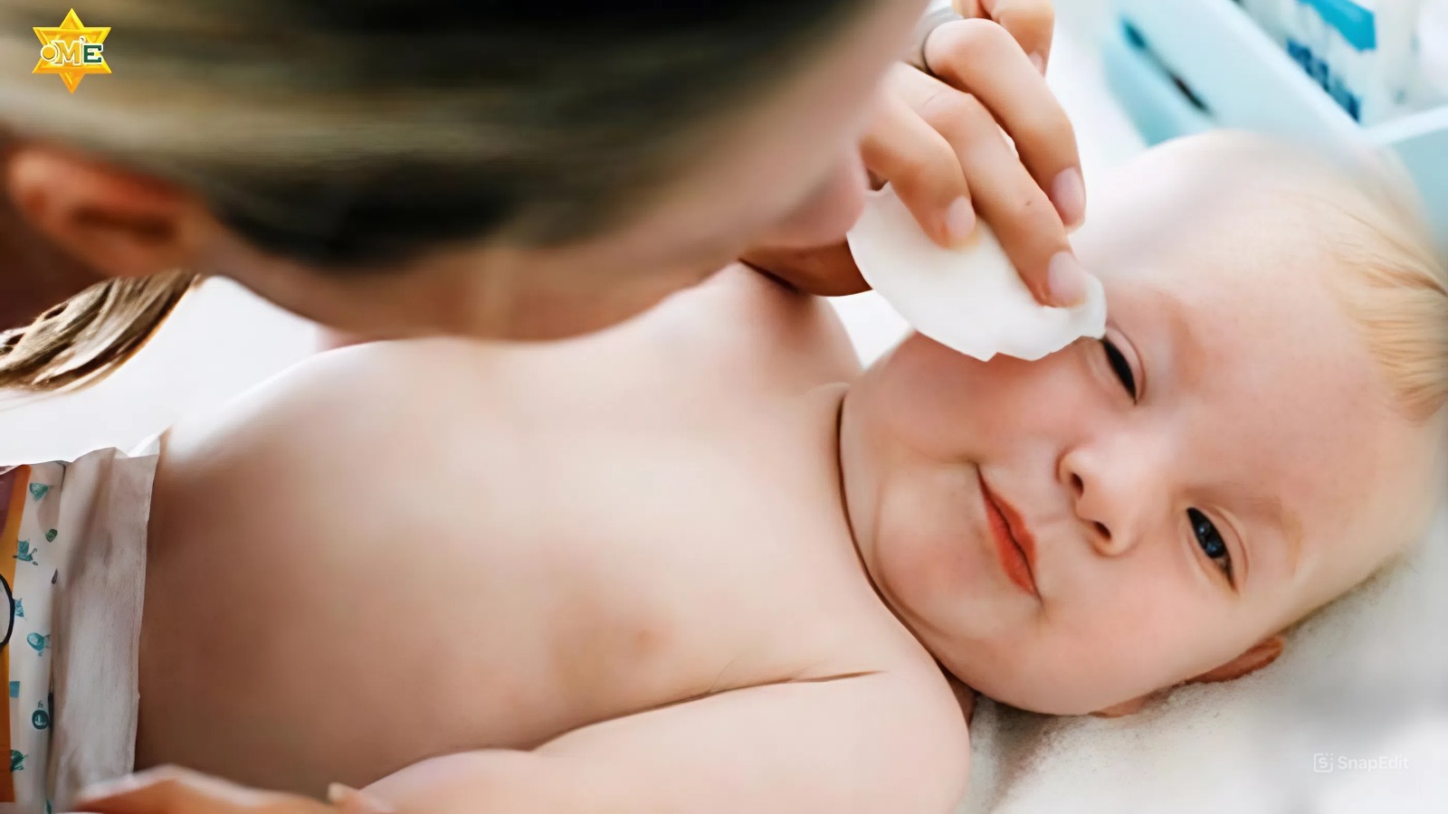 bé sơ sinh tróc da