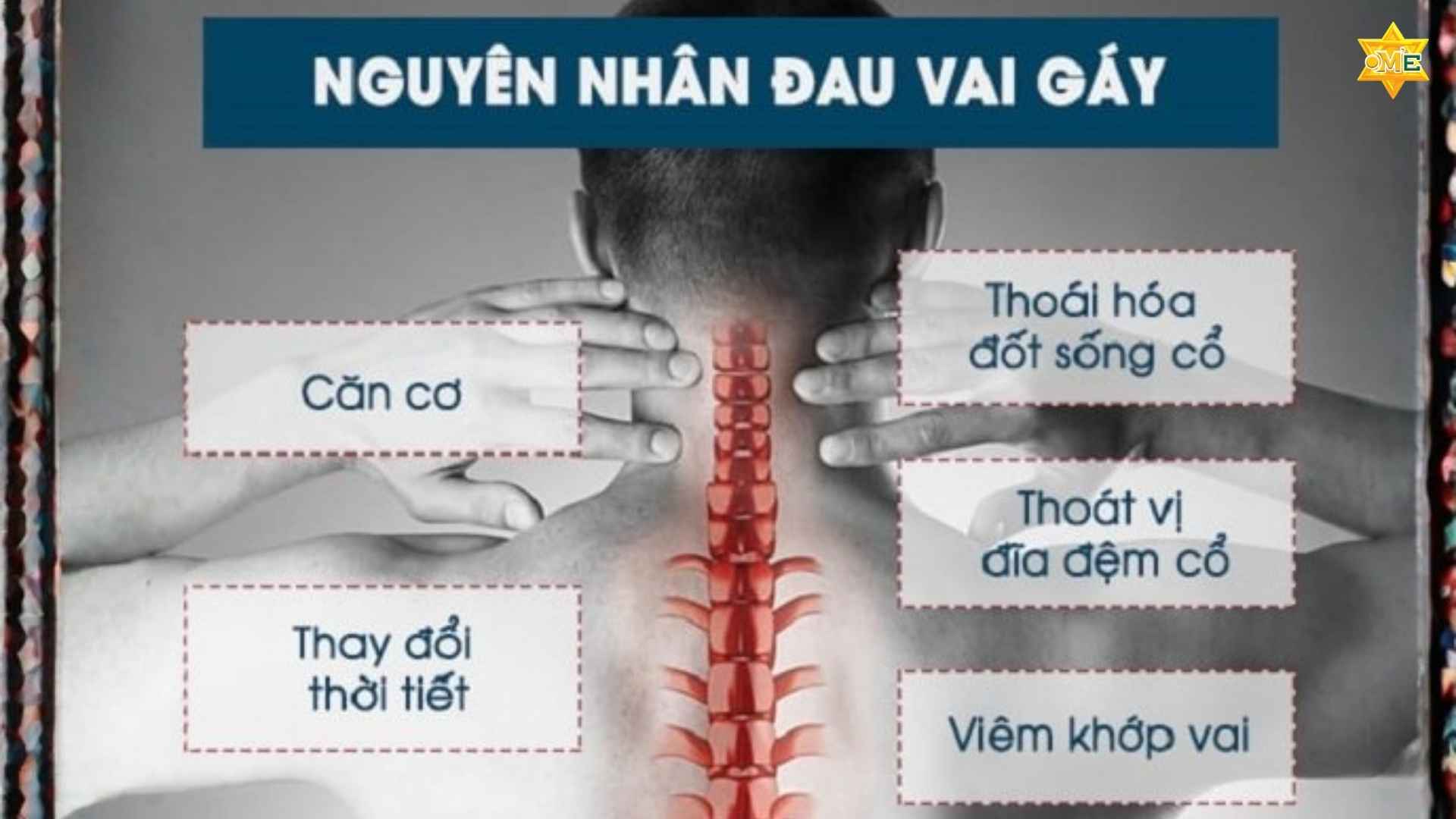 Cách Xoa Bóp Đau Vai Gáy