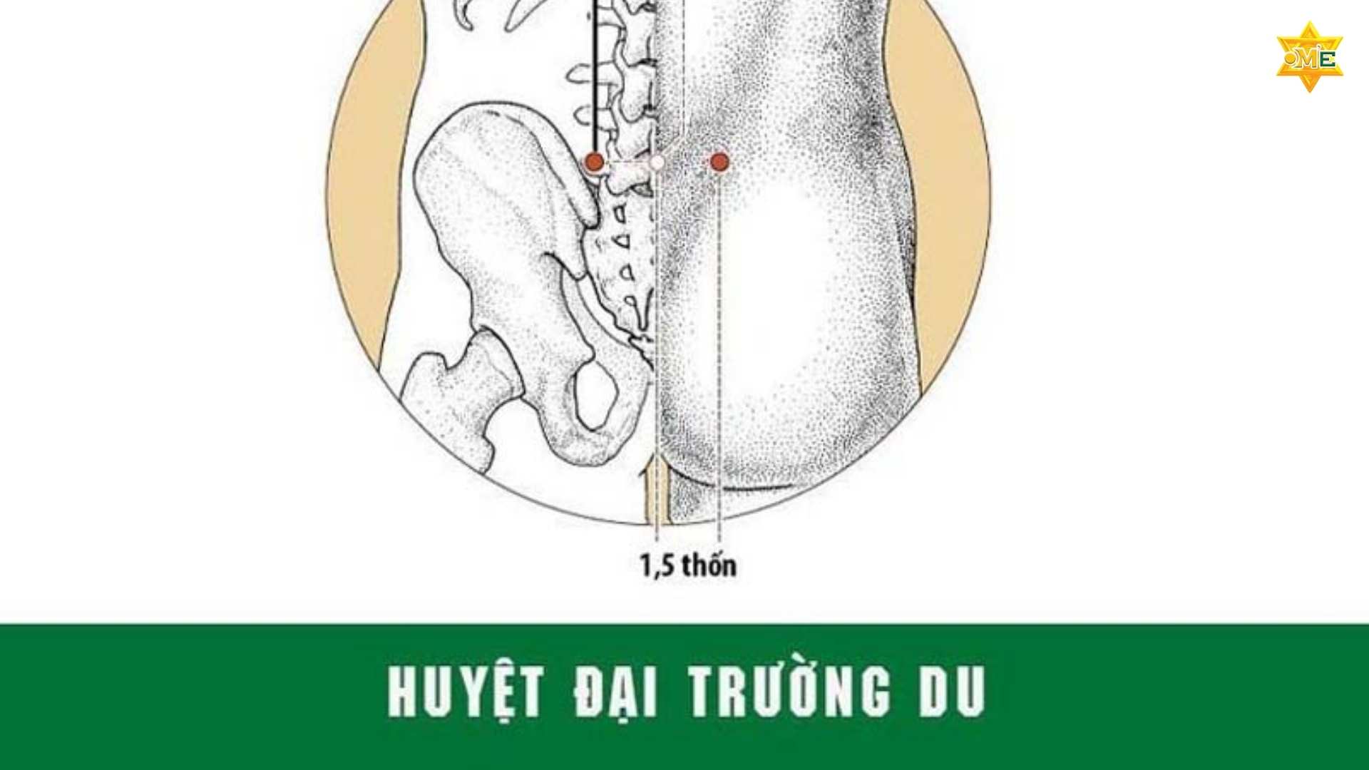 Ấn Huyệt Trị Đau Lưng