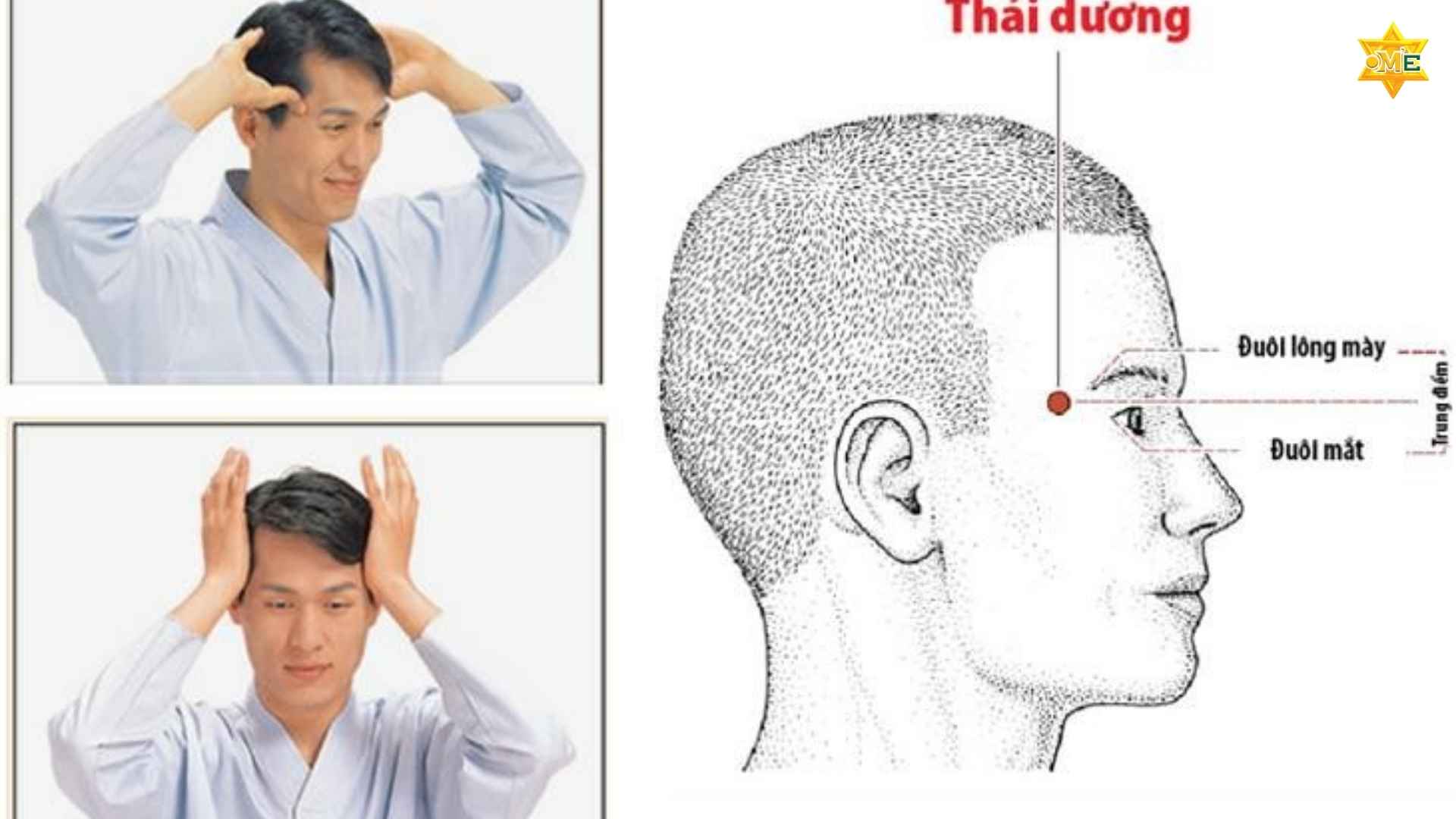 Hướng Dẫn Chi Tiết Xoa Bóp Bấm Huyệt Đau Đầu