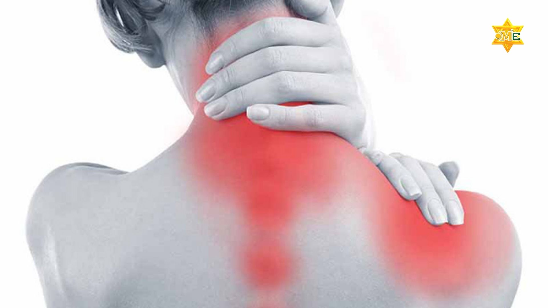 Cách Xoa Bóp Đau Cổ Vai Gáy Hiệu Quả Tại Nhà