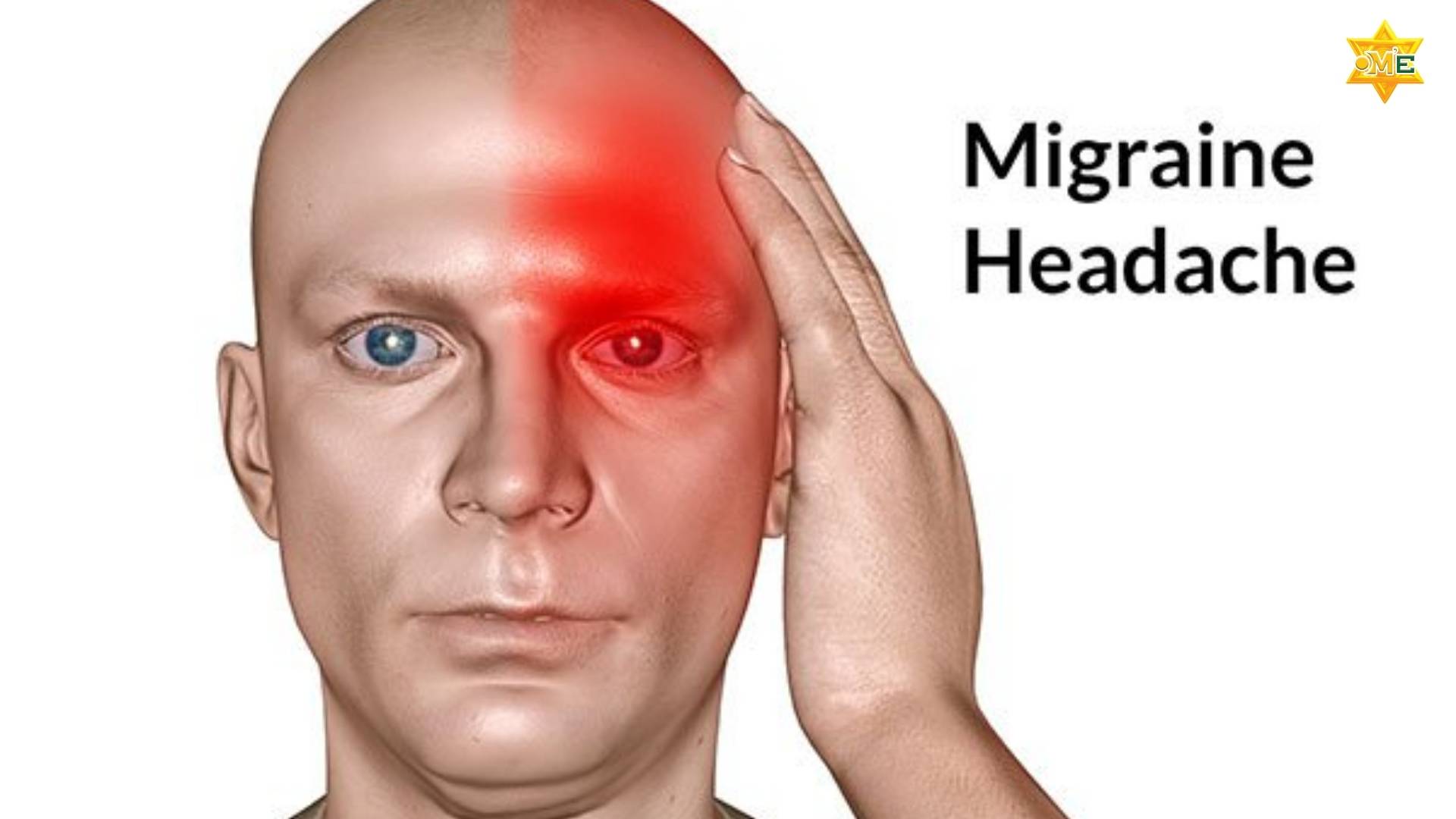 Cách Xoa Bóp Đau Nửa Đầu Bằng Tay