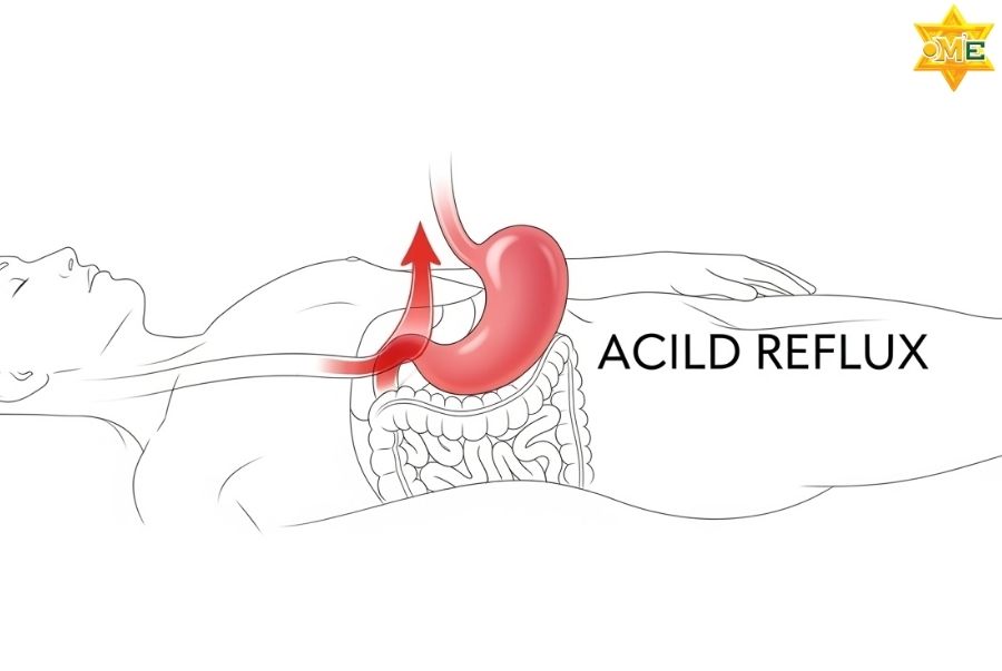 Áp dụng cách xoa bụng chữa đau dạ dày