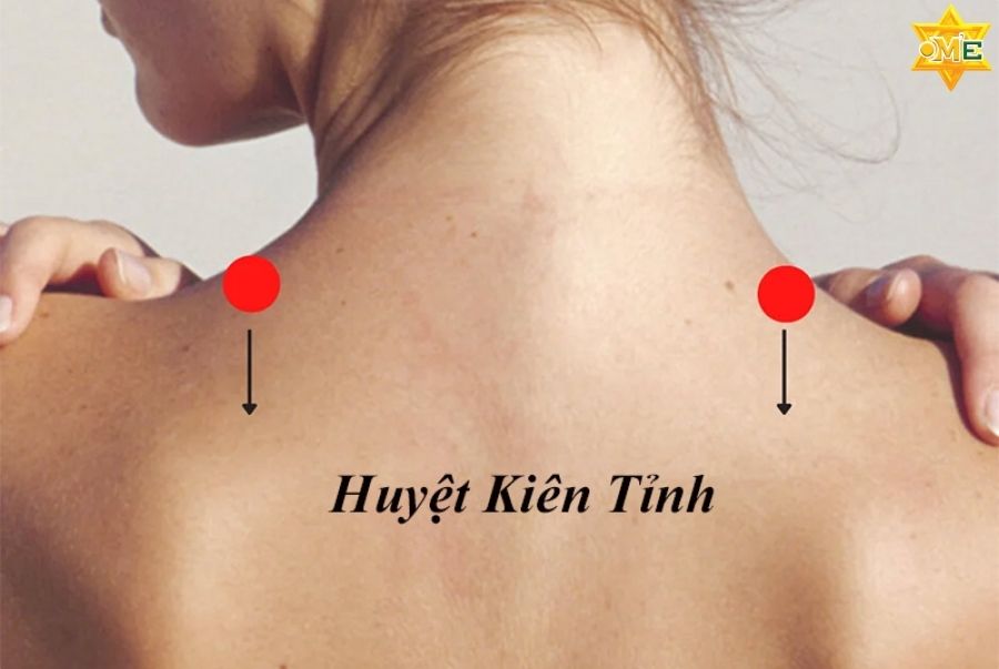 Huyệt kiên tỉnh