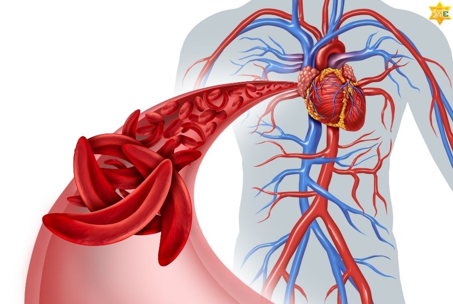 Hướng dẫn cách lưu thông máu ở chân thông qua 6 huyệt đạo