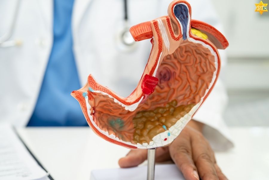 Hướng Dẫn Xoa Bóp Chữa Đau Dạ Dày Chuẩn Y Học Cổ Truyền