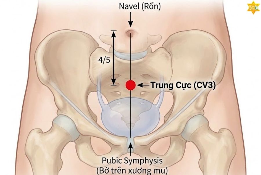 3 công dụng của huyệt trung cực trị bệnh khó nói hiệu quả