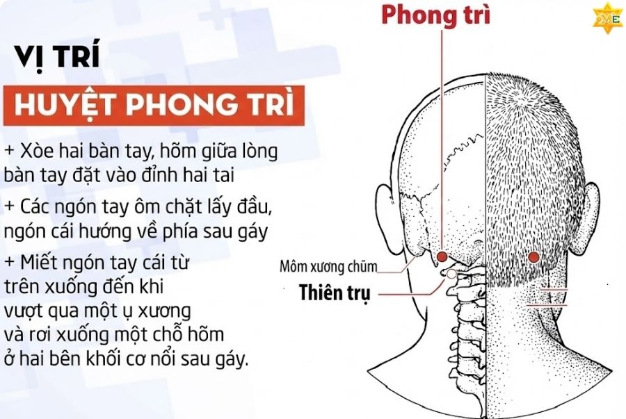 Vị trí huyệt Phong trì nằm ở đâu?