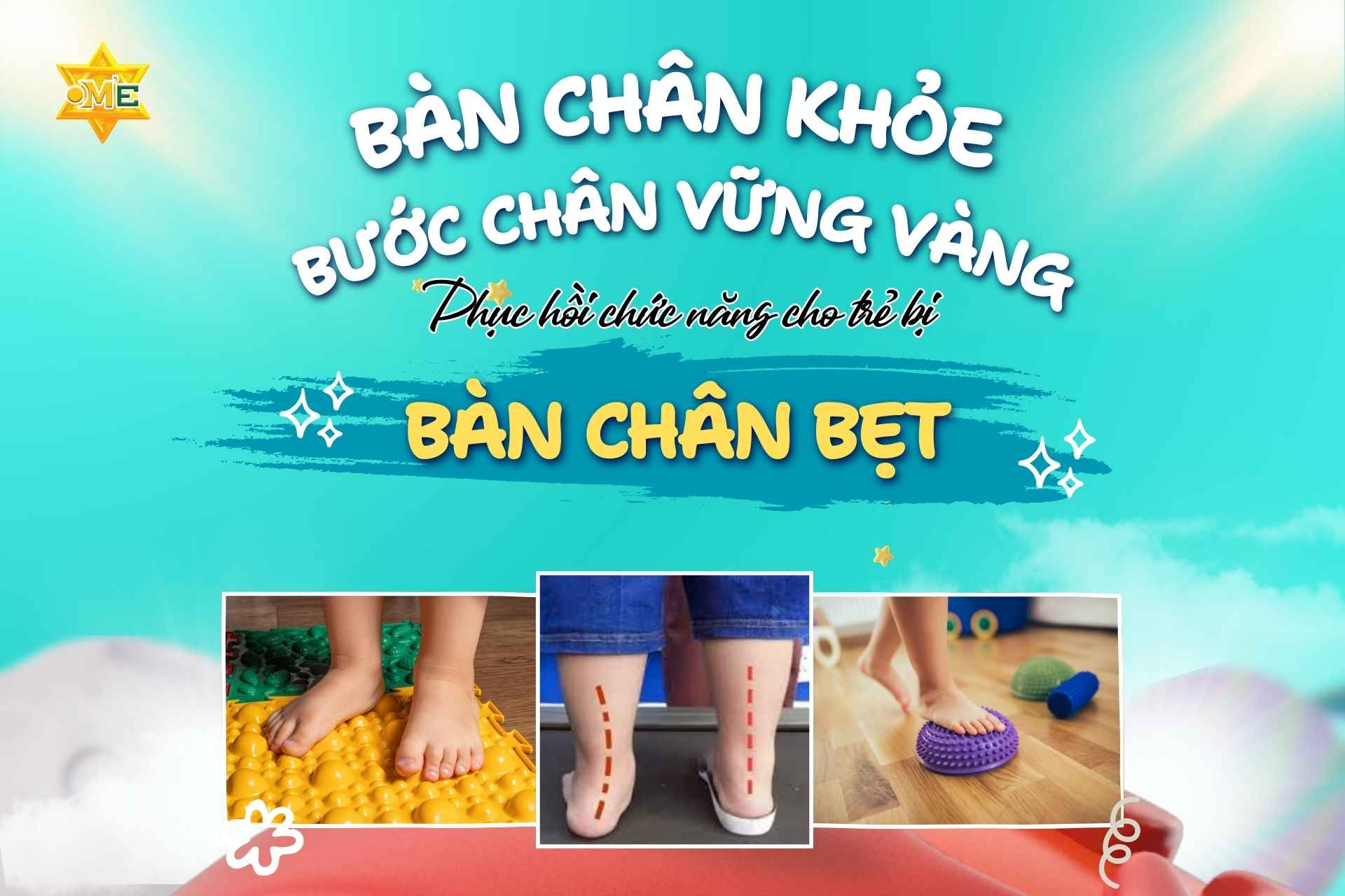 Bàn chân khỏe – bước chân vững vàng: Phục hồi chức năng cho trẻ bị bàn chân bẹt