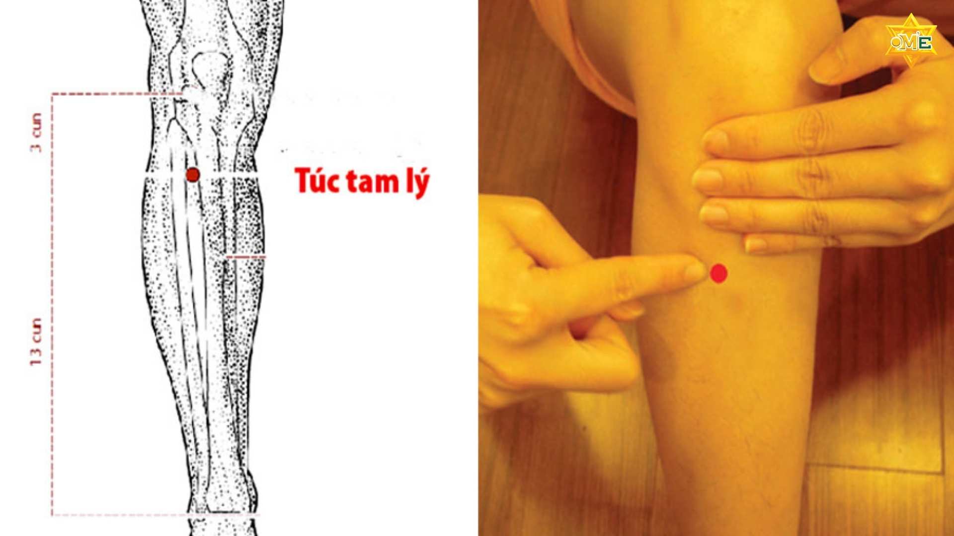 Bấm Huyệt Giảm Cân Có Hiệu Quả Không