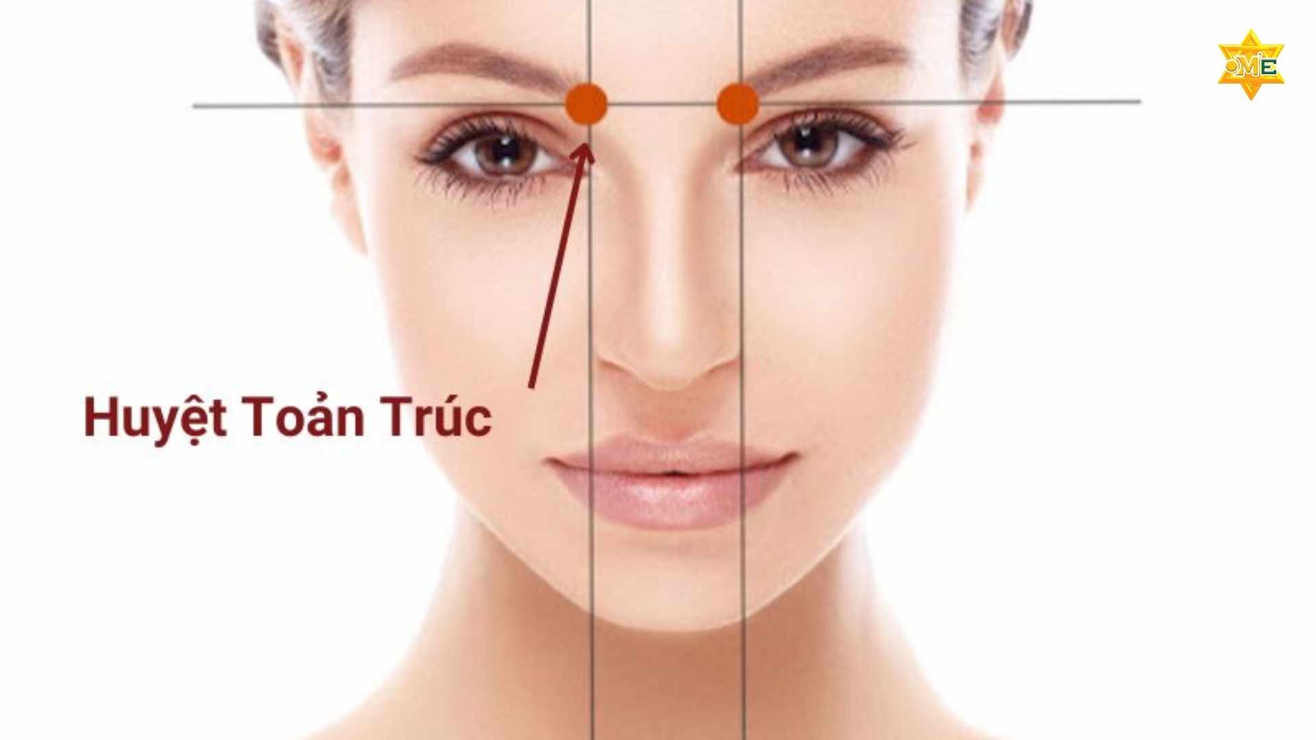 Bản Đồ Các Huyệt Trên Mặt Y Học Cổ Truyền