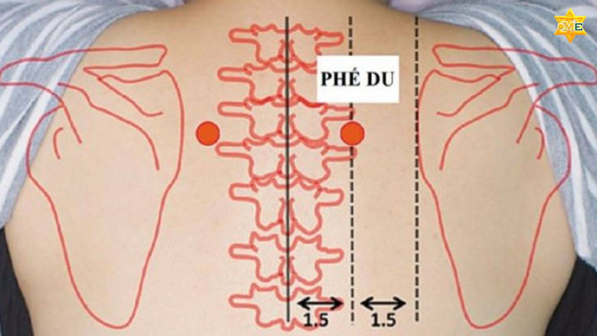 Cách ấn huyệt chữa ho chuẩn Y học cổ truyền