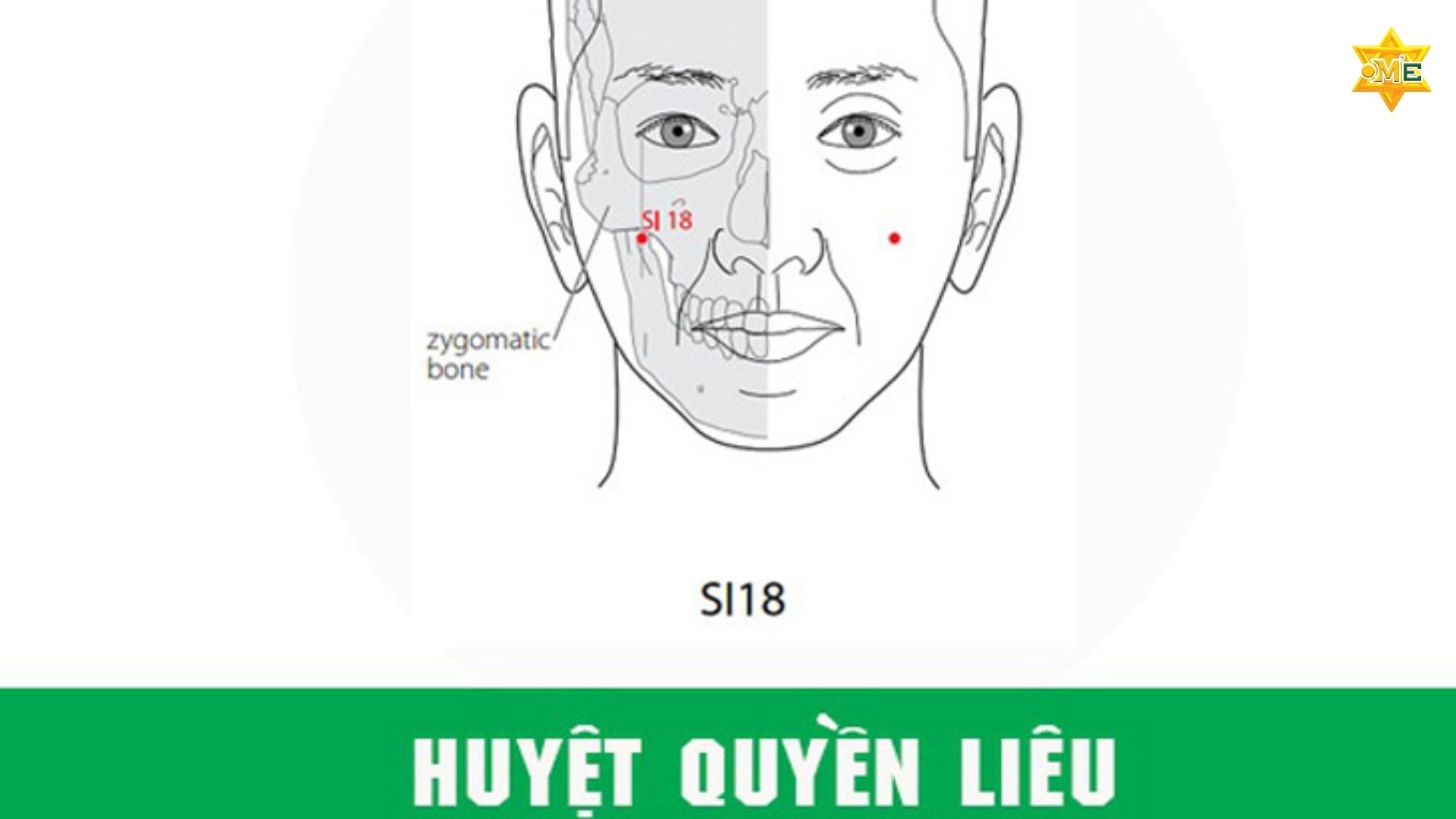 Bản Đồ Các Huyệt Trên Mặt Y Học Cổ Truyền