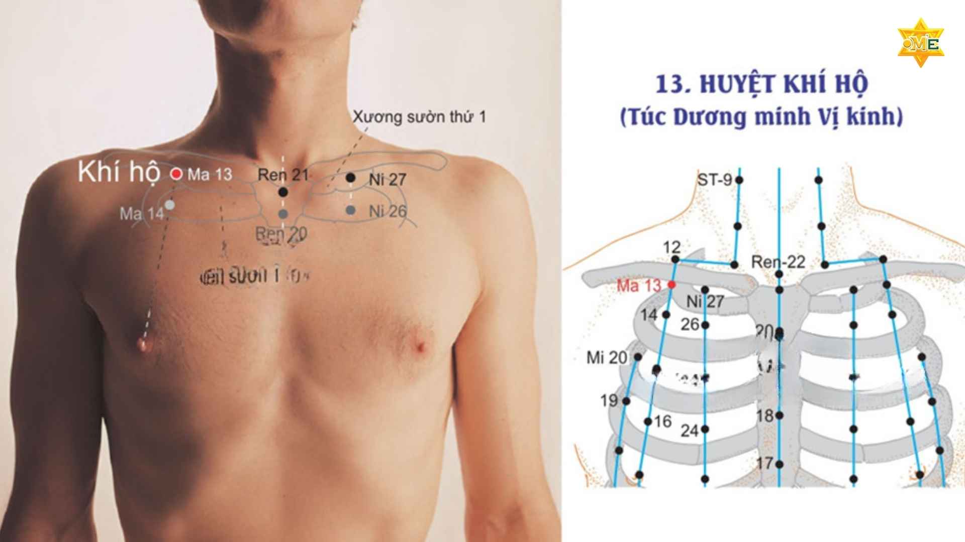 Cách xác định huyệt trên ngực chuẩn xác nhất