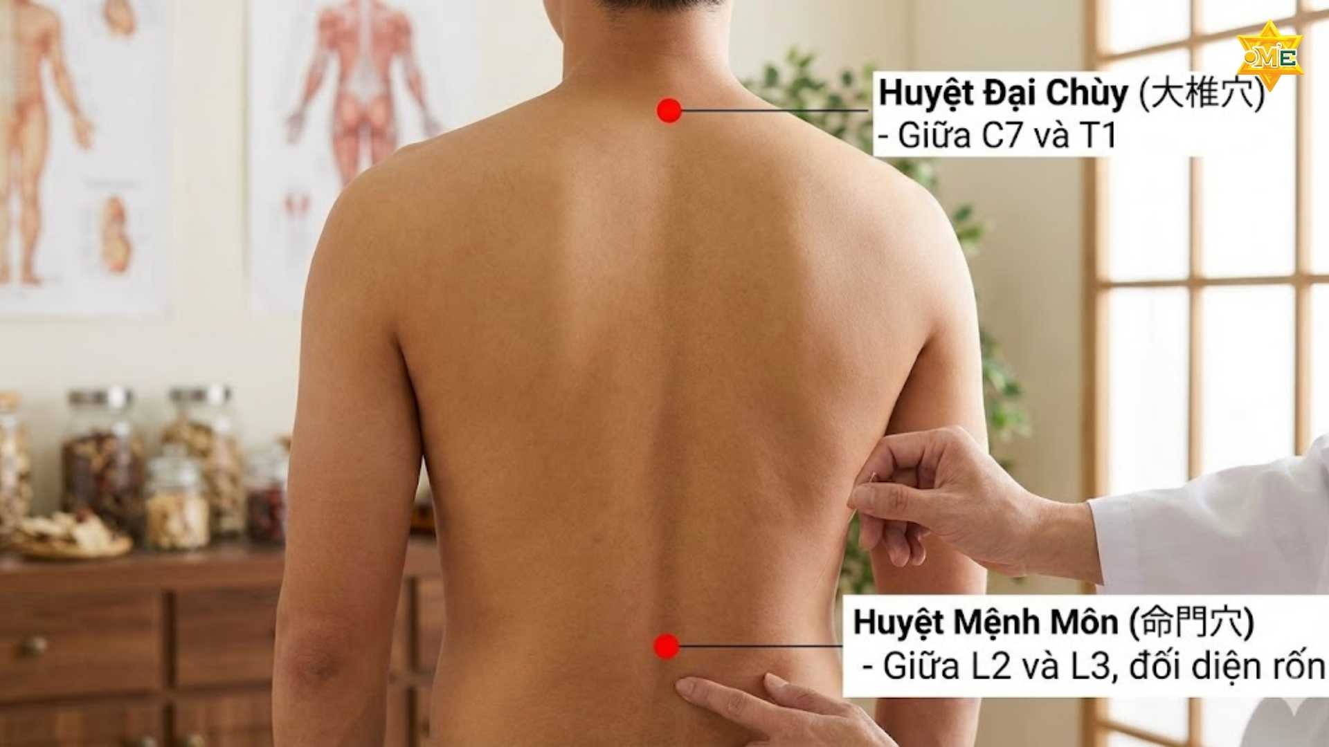 Cách xác định huyệt trên lưng để giảm đau