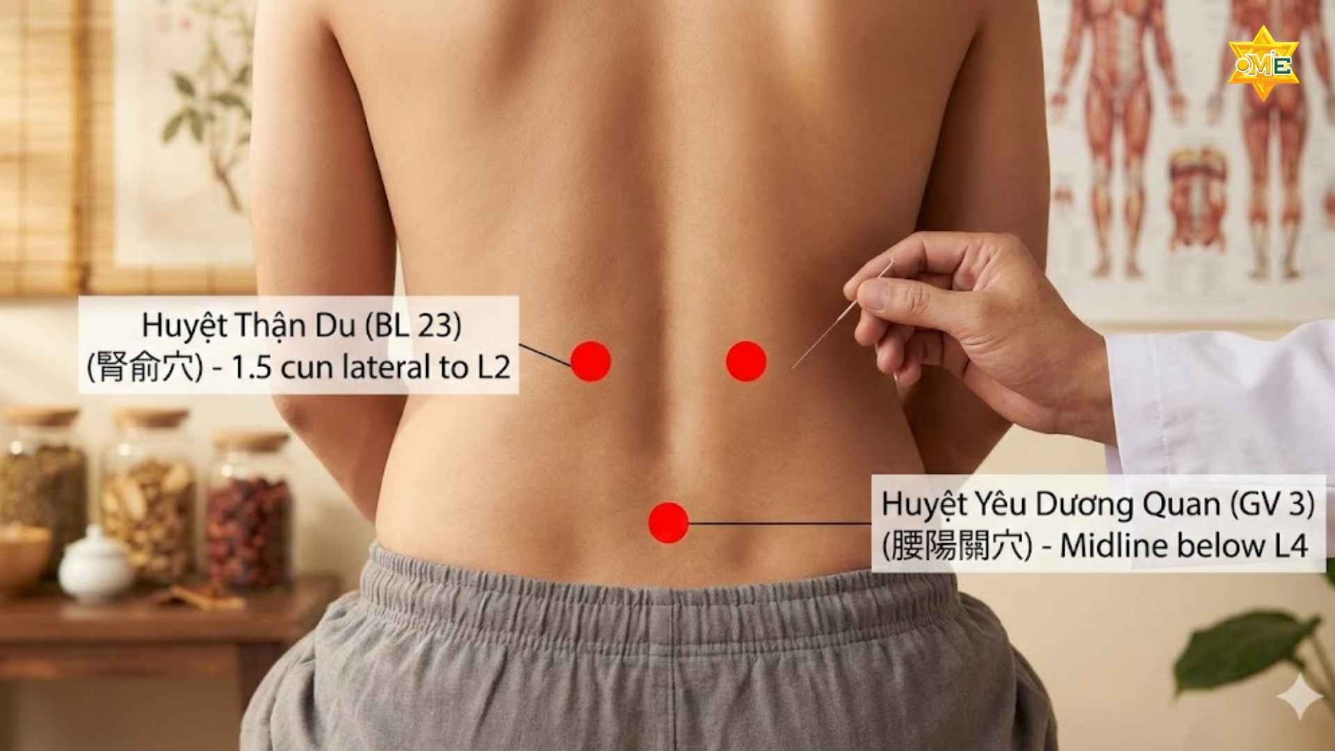 Cách xác định huyệt trên lưng để giảm đau