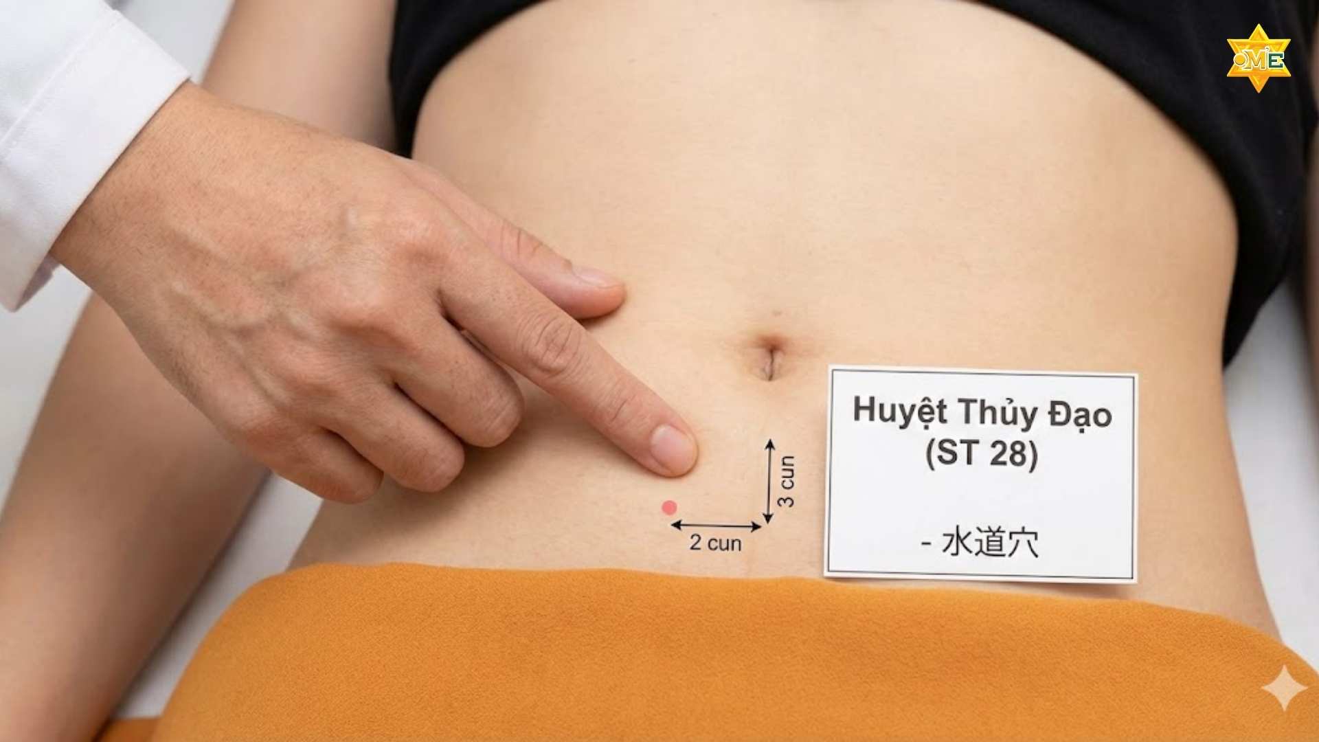 cách xác định huyệt trên bụng chuẩn y học cổ truyền