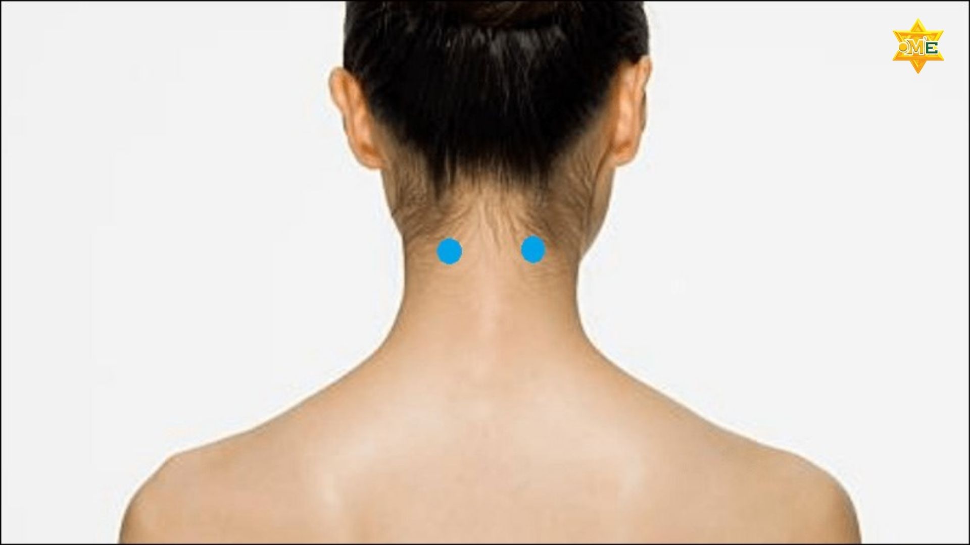 Hướng dẫn cách xác định huyệt An Miên trị mất ngủ