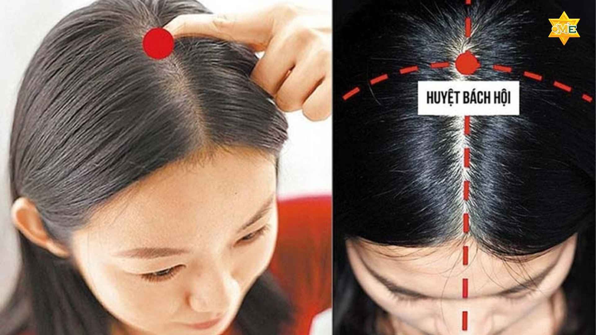 Hướng dẫn cách xác định huyệt trên đầu