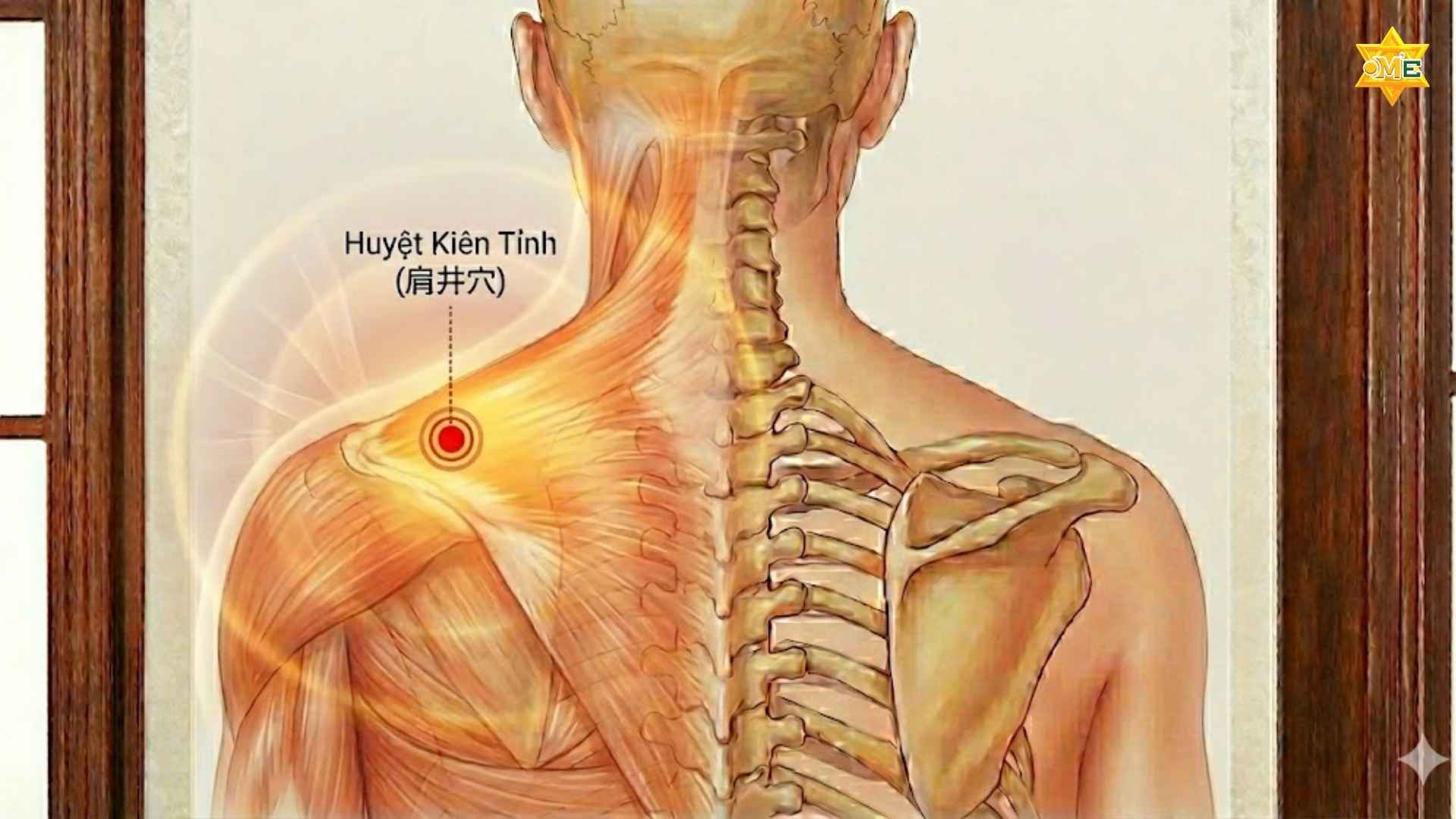 Cách xác định huyệt trên vai gáy chuẩn xác trị đau nhức 