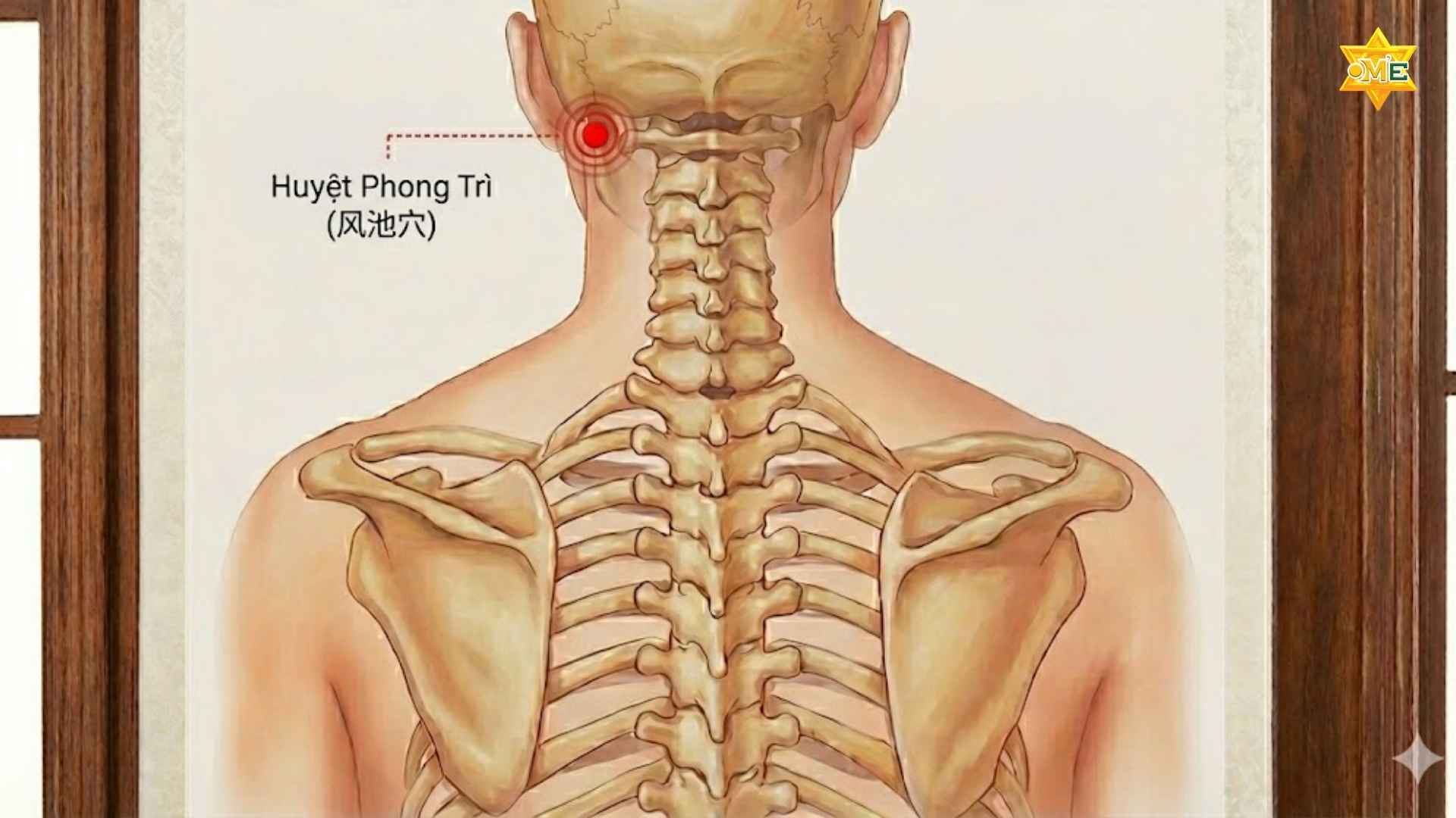 Cách xác định huyệt trên vai gáy chuẩn xác trị đau nhức 