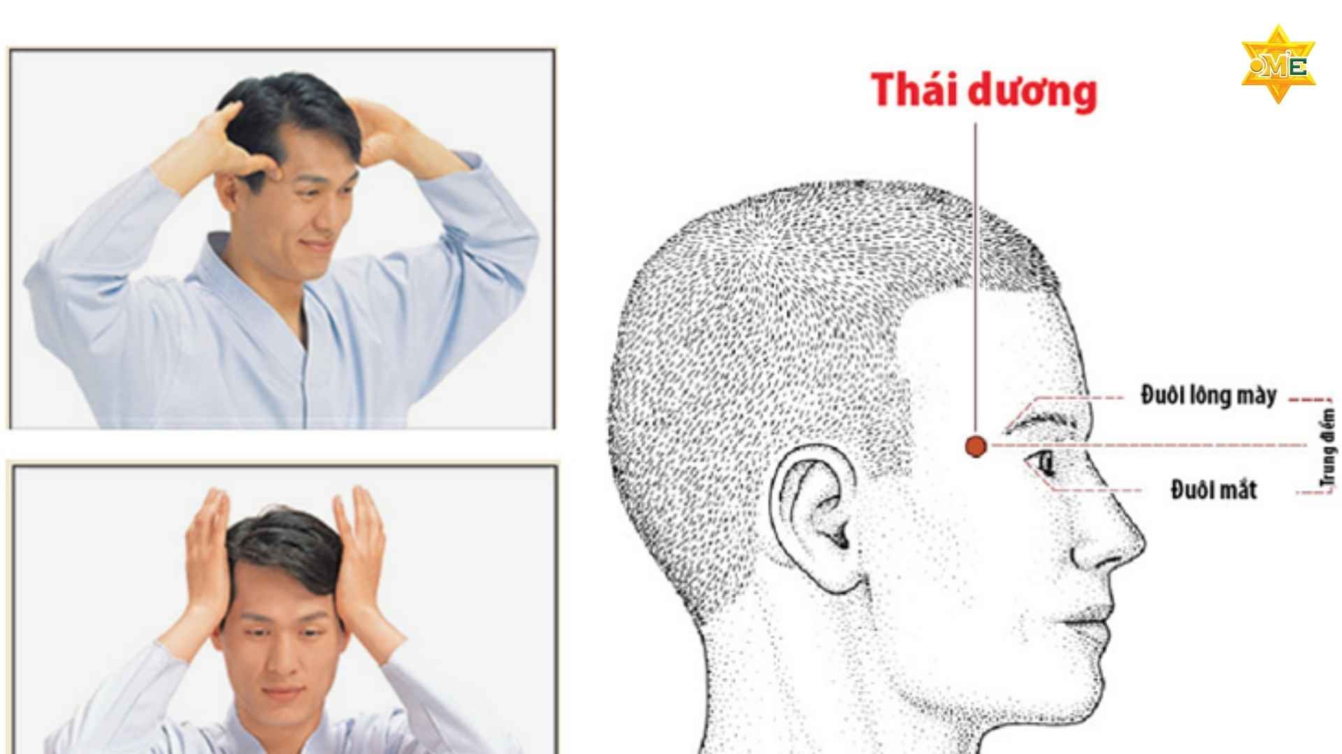 Cách xác định huyệt trên mặt chuẩn y học cổ truyền