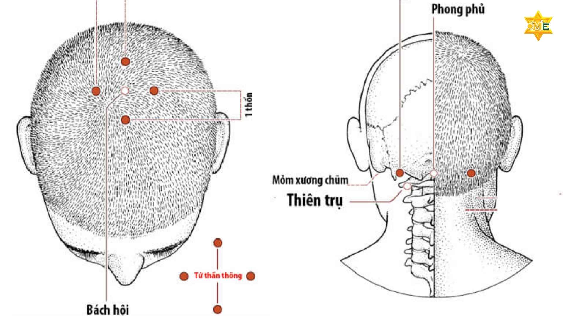 Hướng dẫn cách xác định huyệt trên đầu