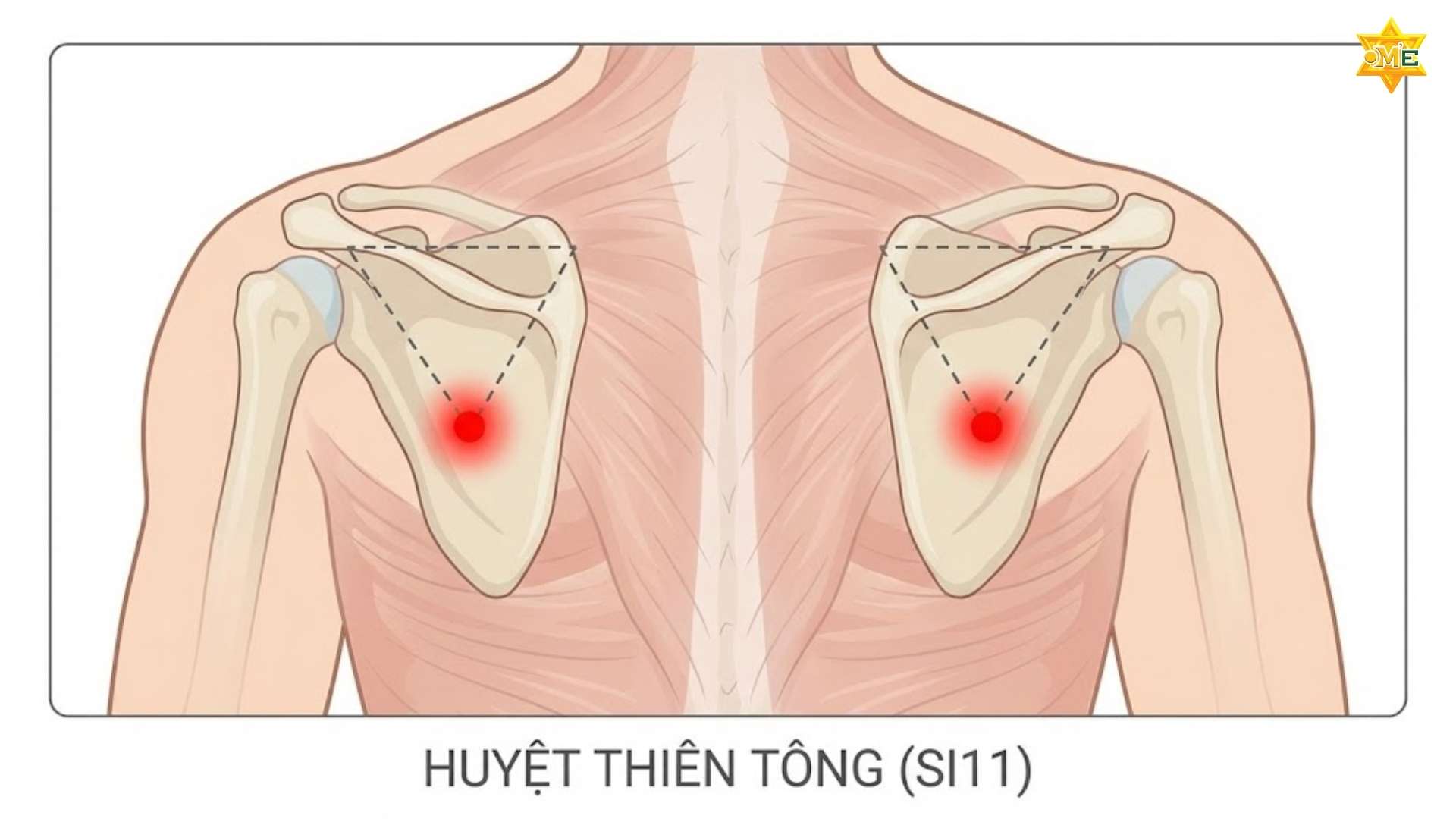 Sơ Đồ Các Huyệt Vùng Cổ Vai Gáy