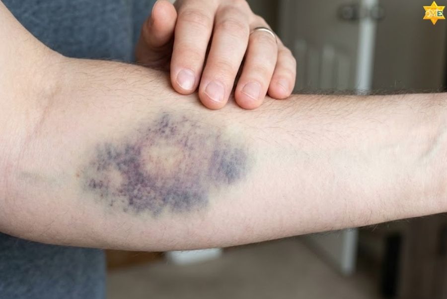 Thắc mắc thường gặp về tần suất và tác dụng phụ