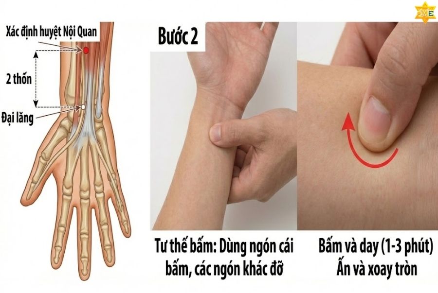 Hướng dẫn cách bấm huyệt Nội Quan hiệu quả