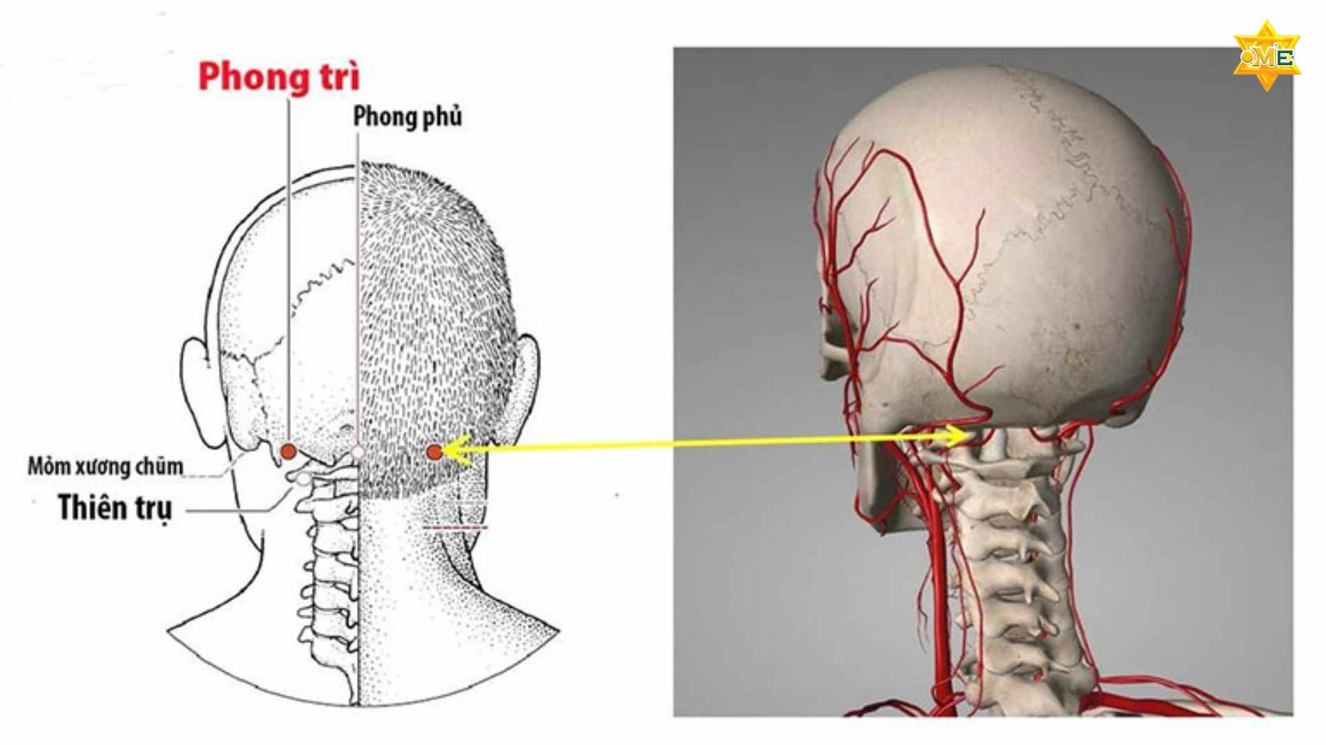 Cách xác định huyệt phong trì chuẩn xác