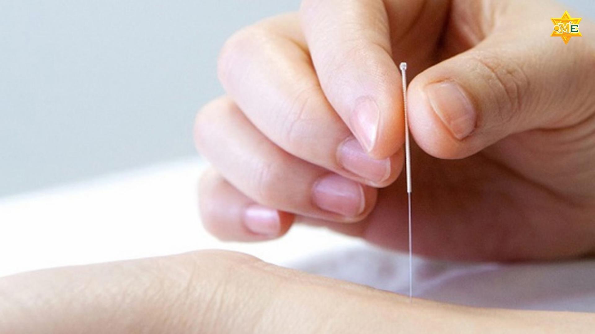 Hướng dẫn cách xác định huyệt Liệt khuyết