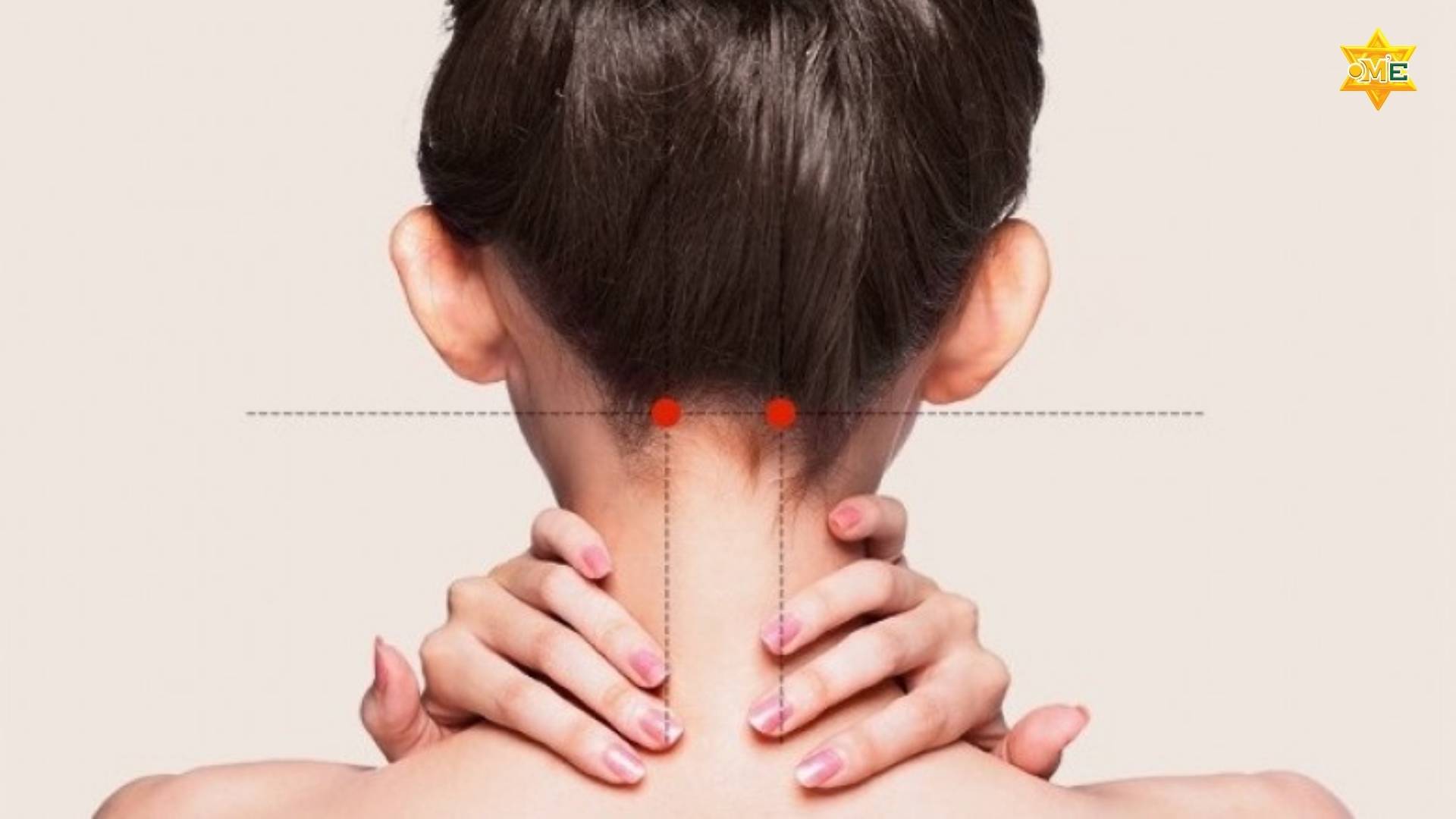 Cách xác định huyệt phong trì chuẩn xác