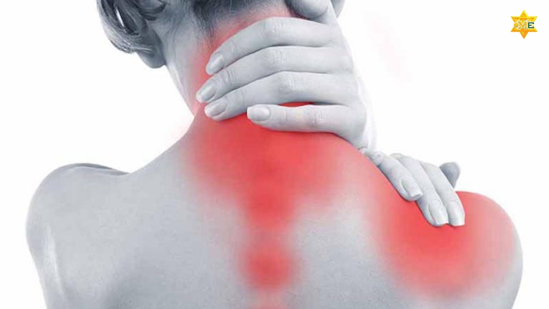 Cách xác định huyệt phong trì chuẩn xác