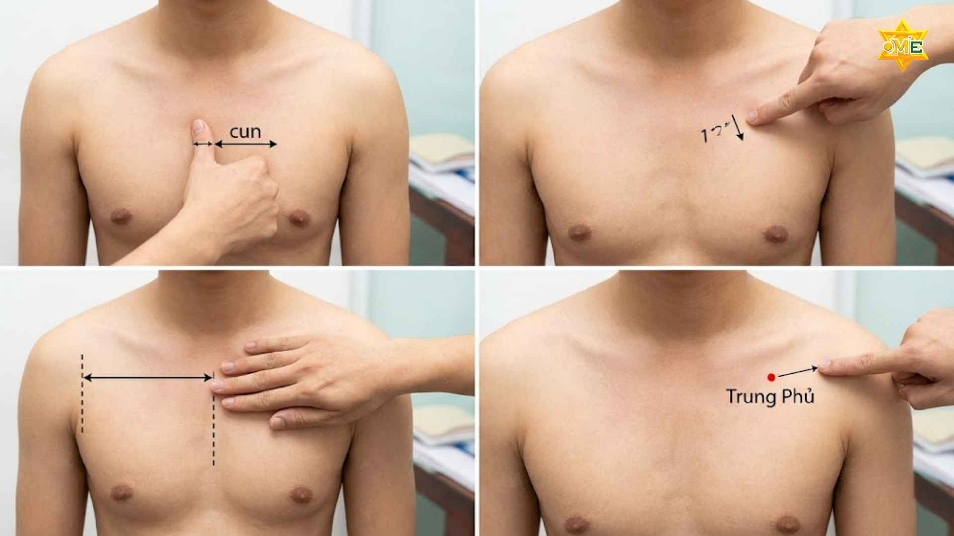 Cách xác định huyệt Trung Phủ