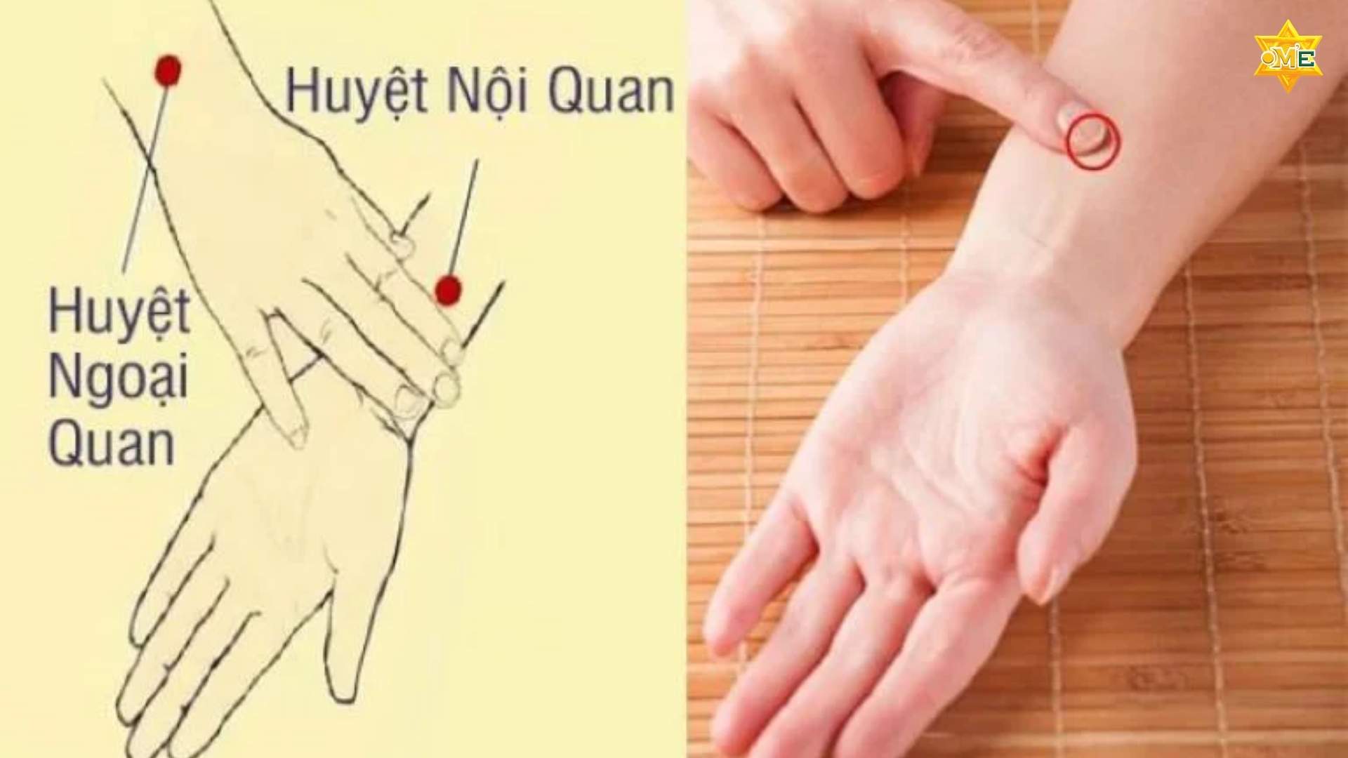 Cách xác định huyệt nội quan chuẩn xác