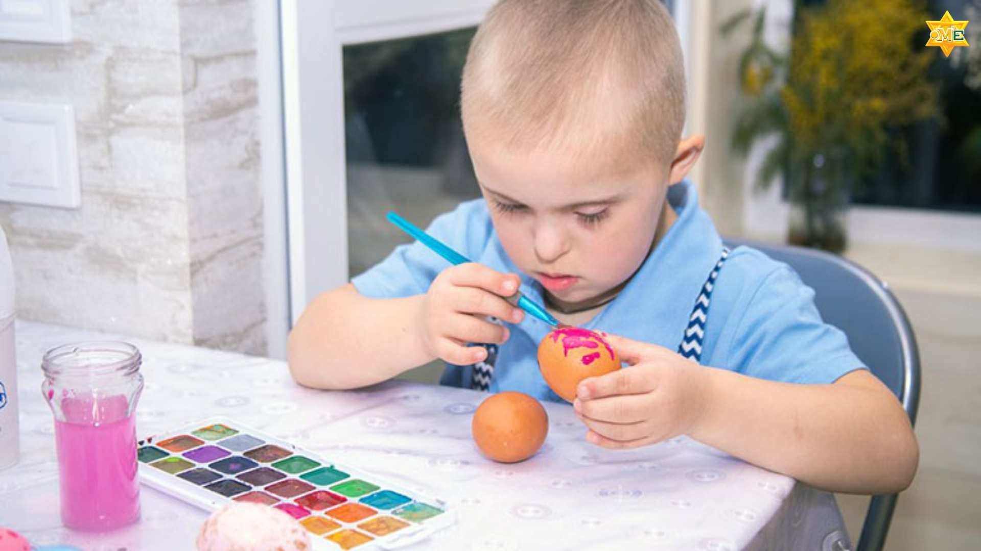 Chậm phát triển trí tuệ ở trẻ em 