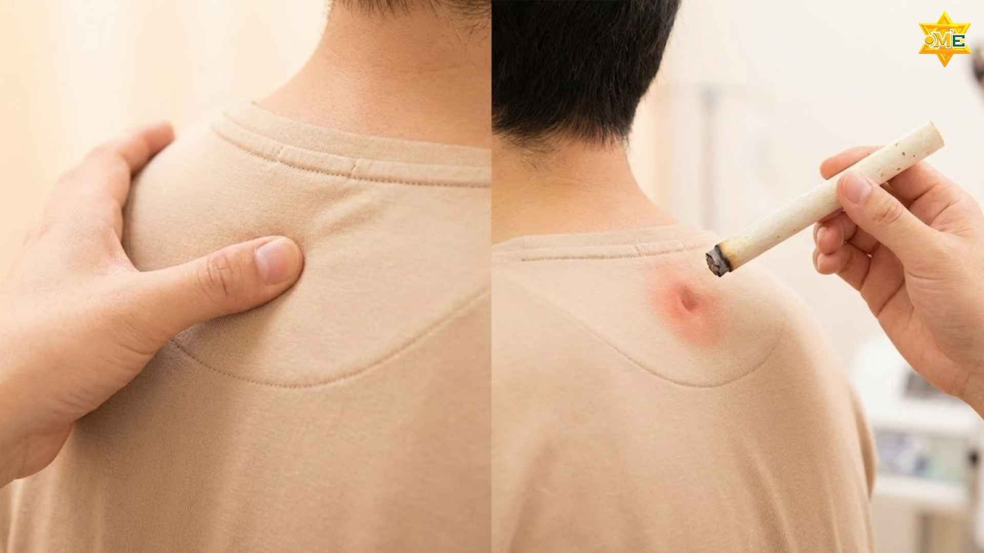 Cách xác định huyệt Phế Du chuẩn xác