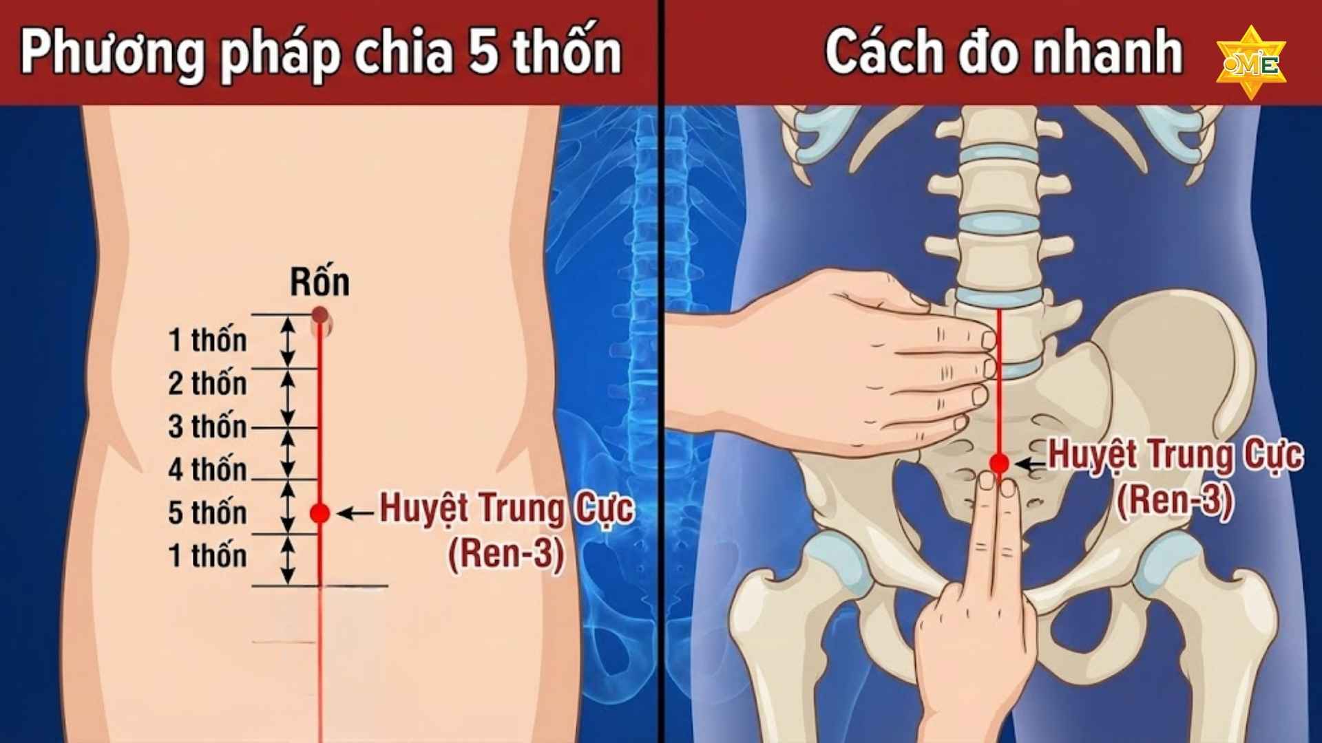 Hướng dẫn cách xác định huyệt Trung Cực 
