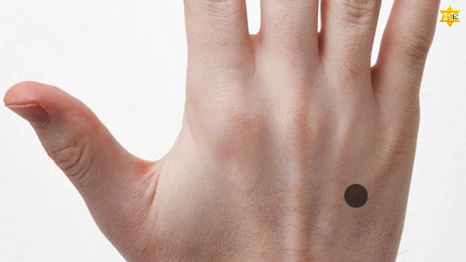 Cách xác định huyệt trung chữ chuẩn xác